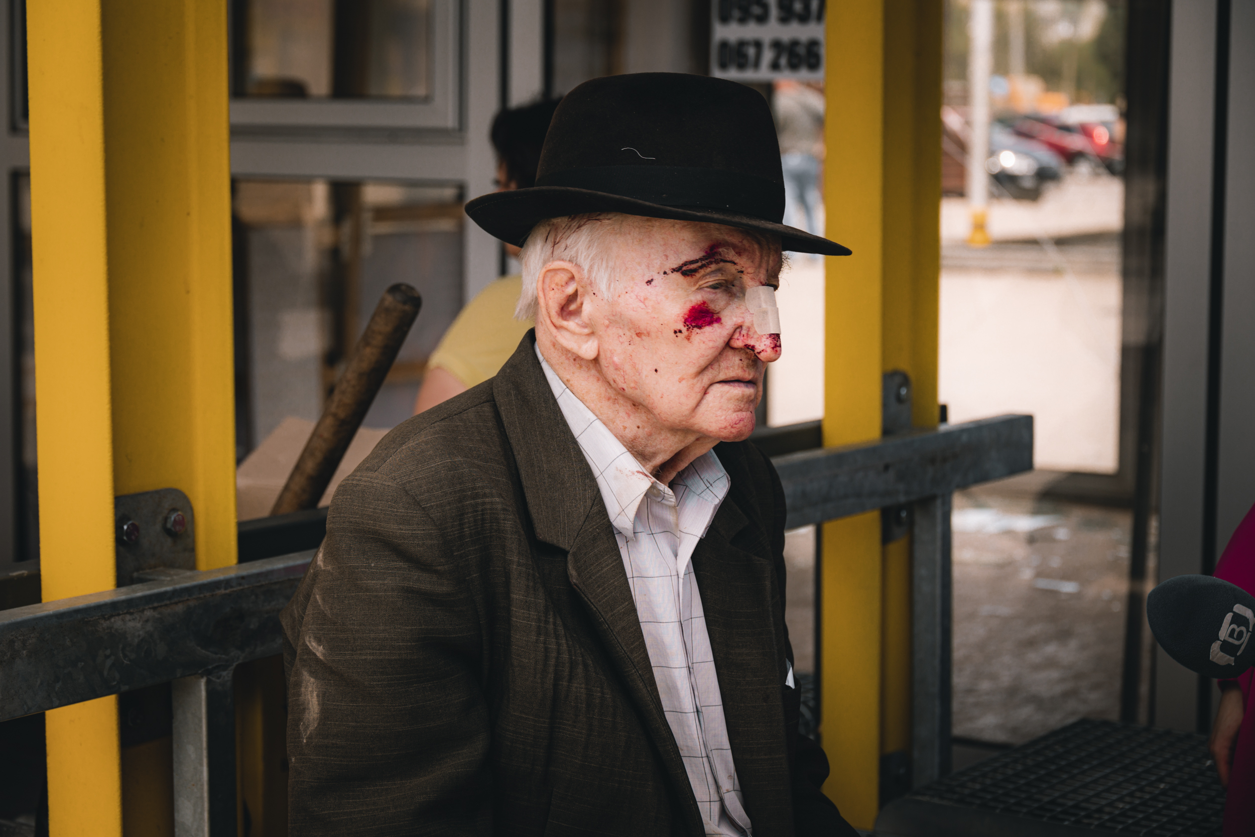 89-річний Георгій Васильович отримав поранення склом внаслідок ворожої атаки