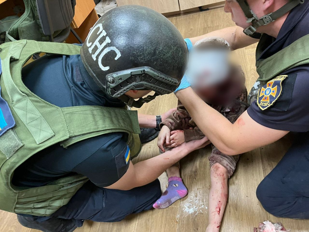 Працівники ДСНС надають допомогу постраждалій дівчинці 